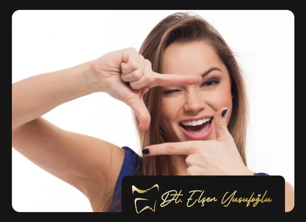 Gülüş Estetiği