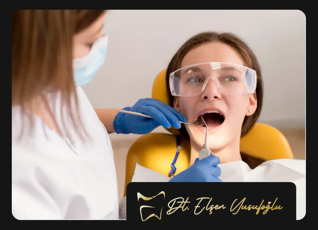 After Root Canal Treatment