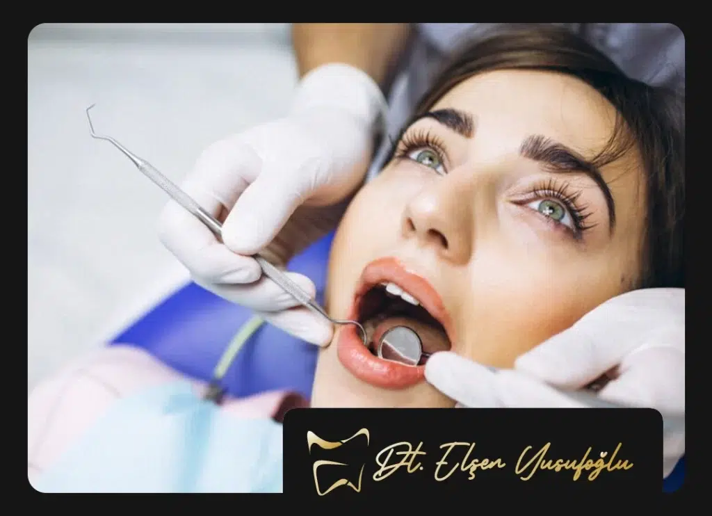 Kanal Tedavisi Ne Kadar Sürer?