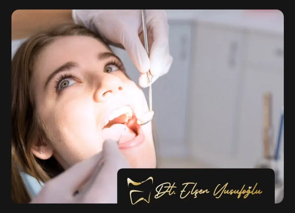 Kanal Tedavisi Ankara