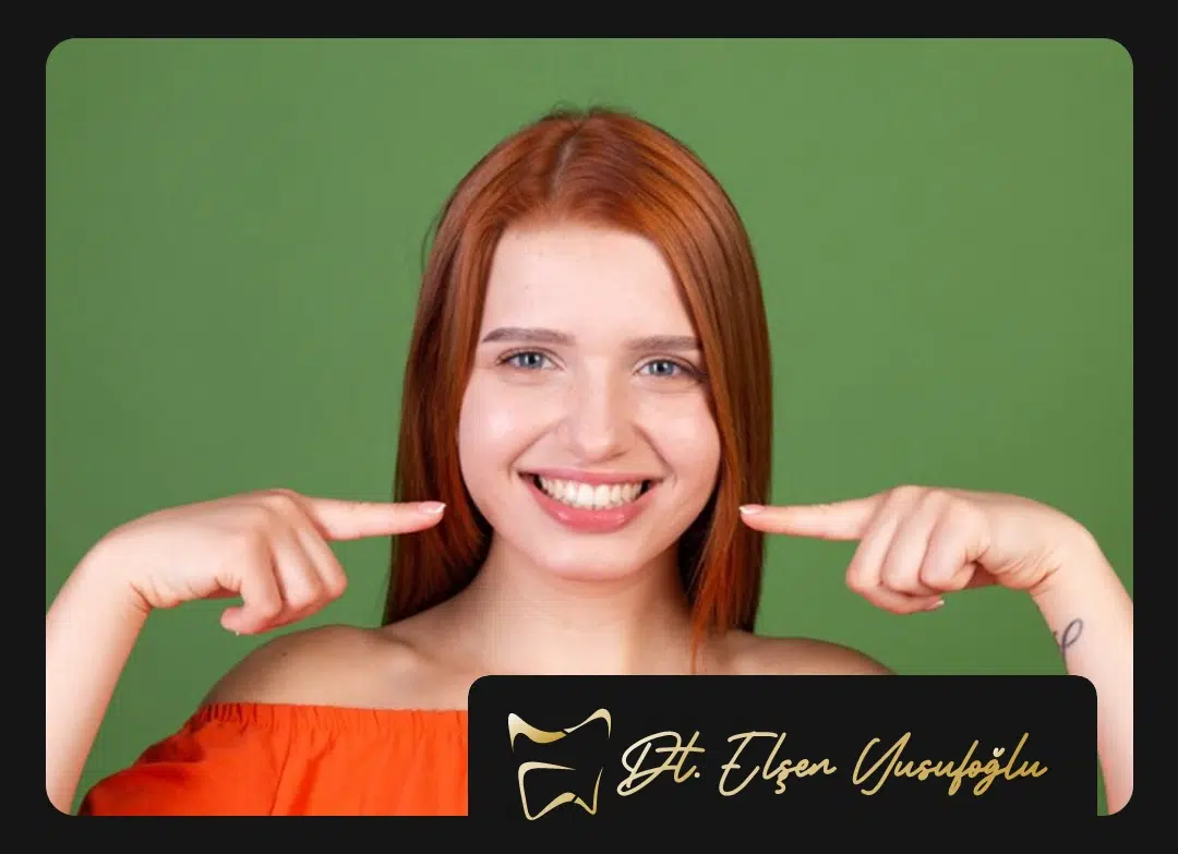 Ankara Smile Design Prices