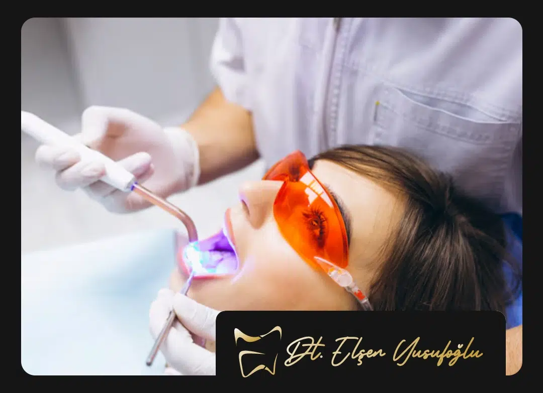 Root Canal Treatment Prices 2025