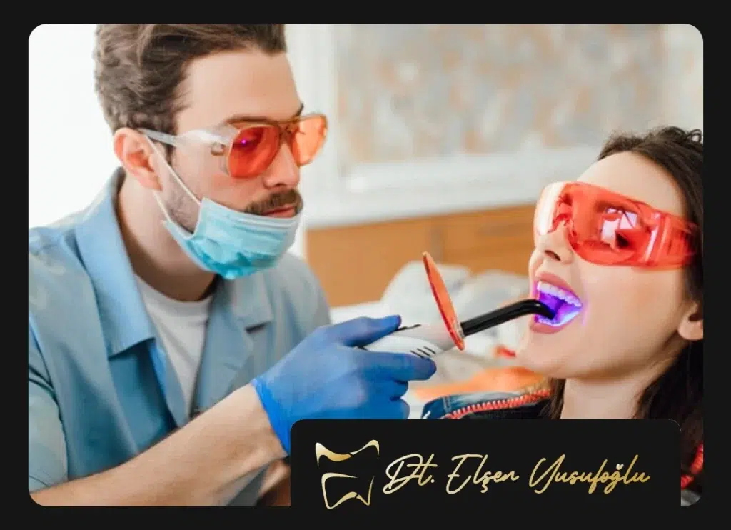 Kalıcı Diş Beyazlatma Ankara