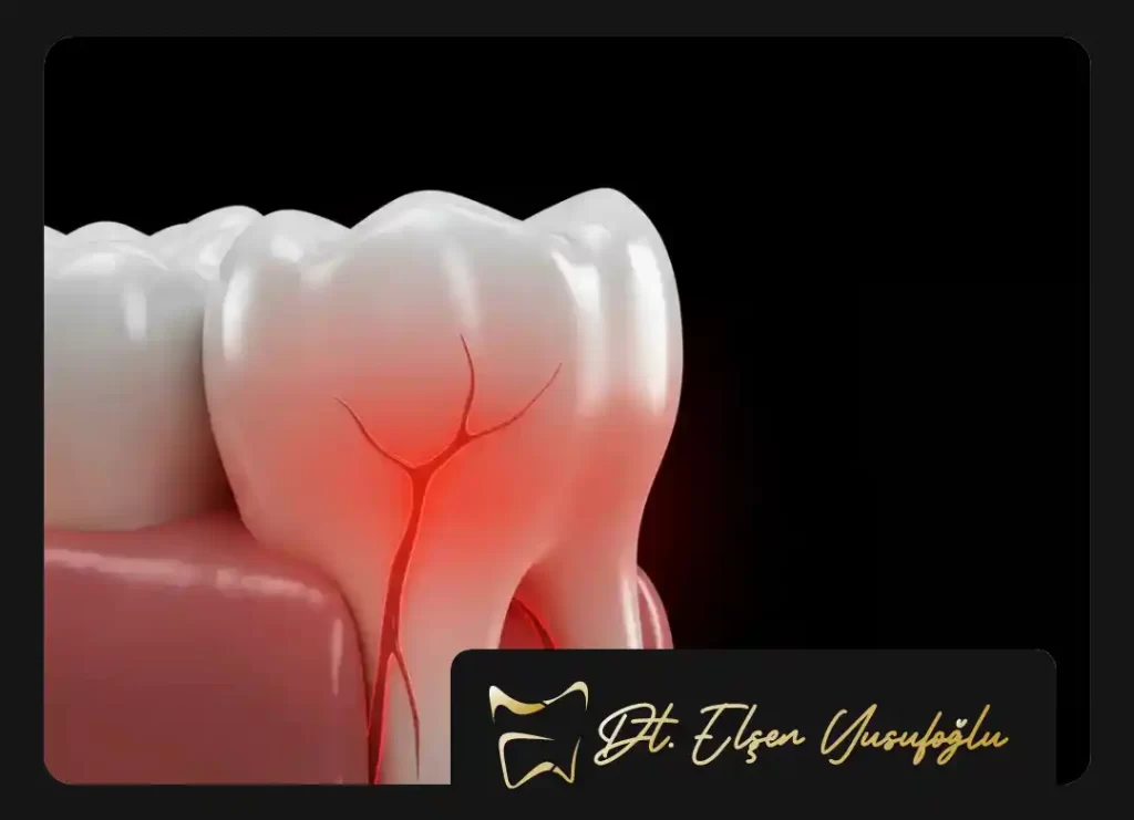 What is good for toothache at home