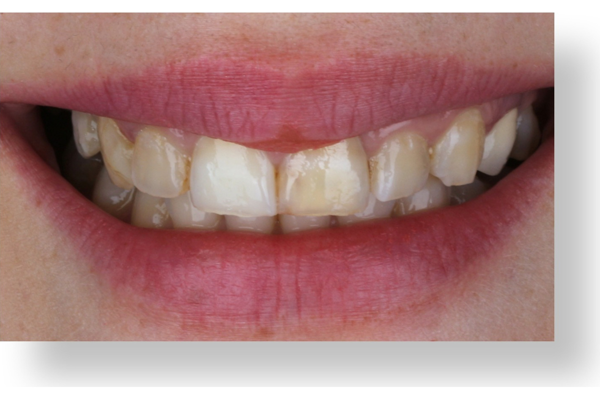 Before image