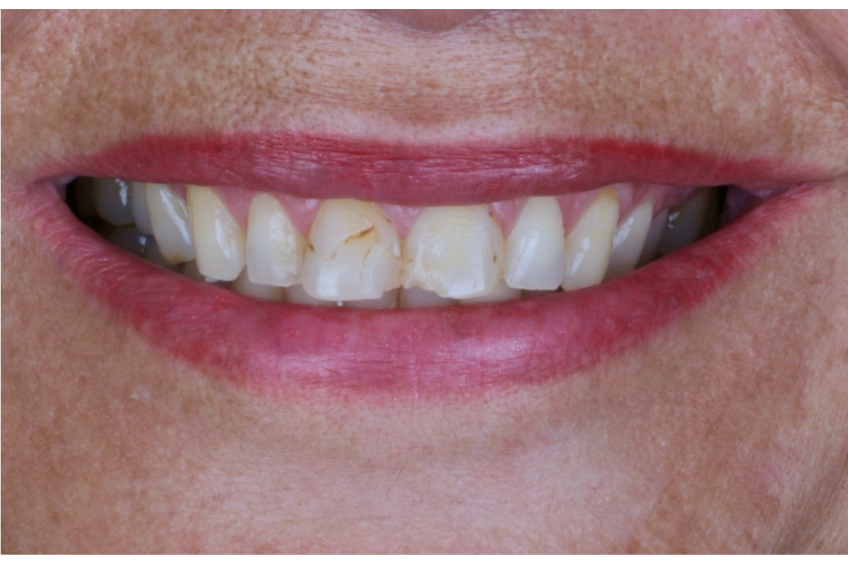 Before image