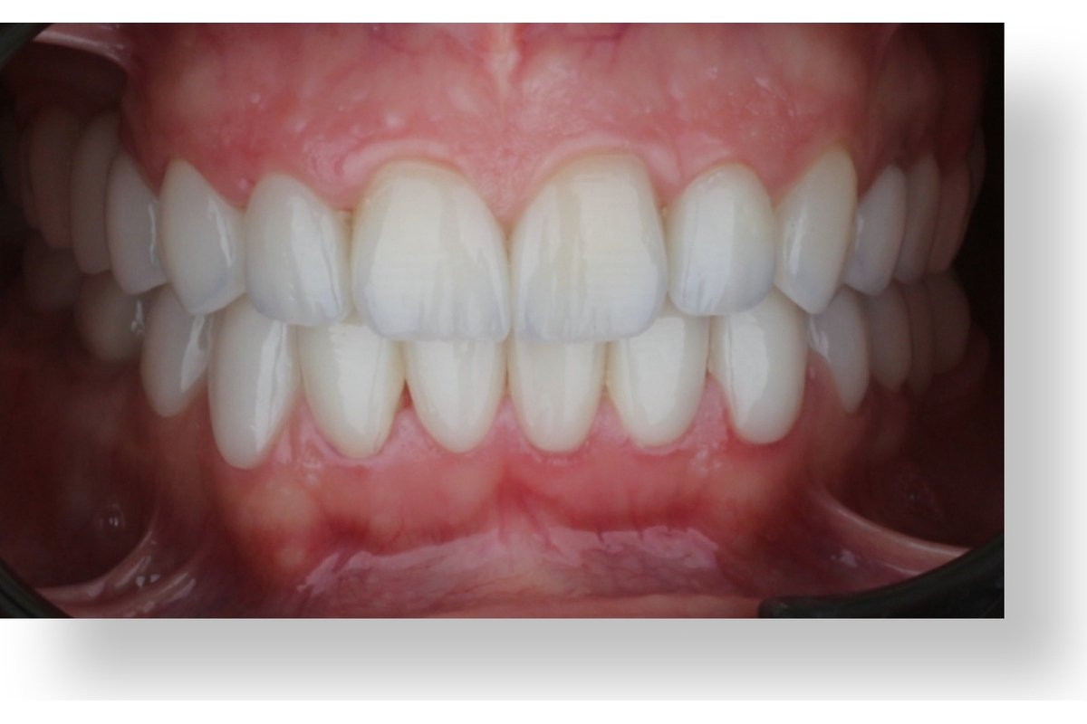 After image