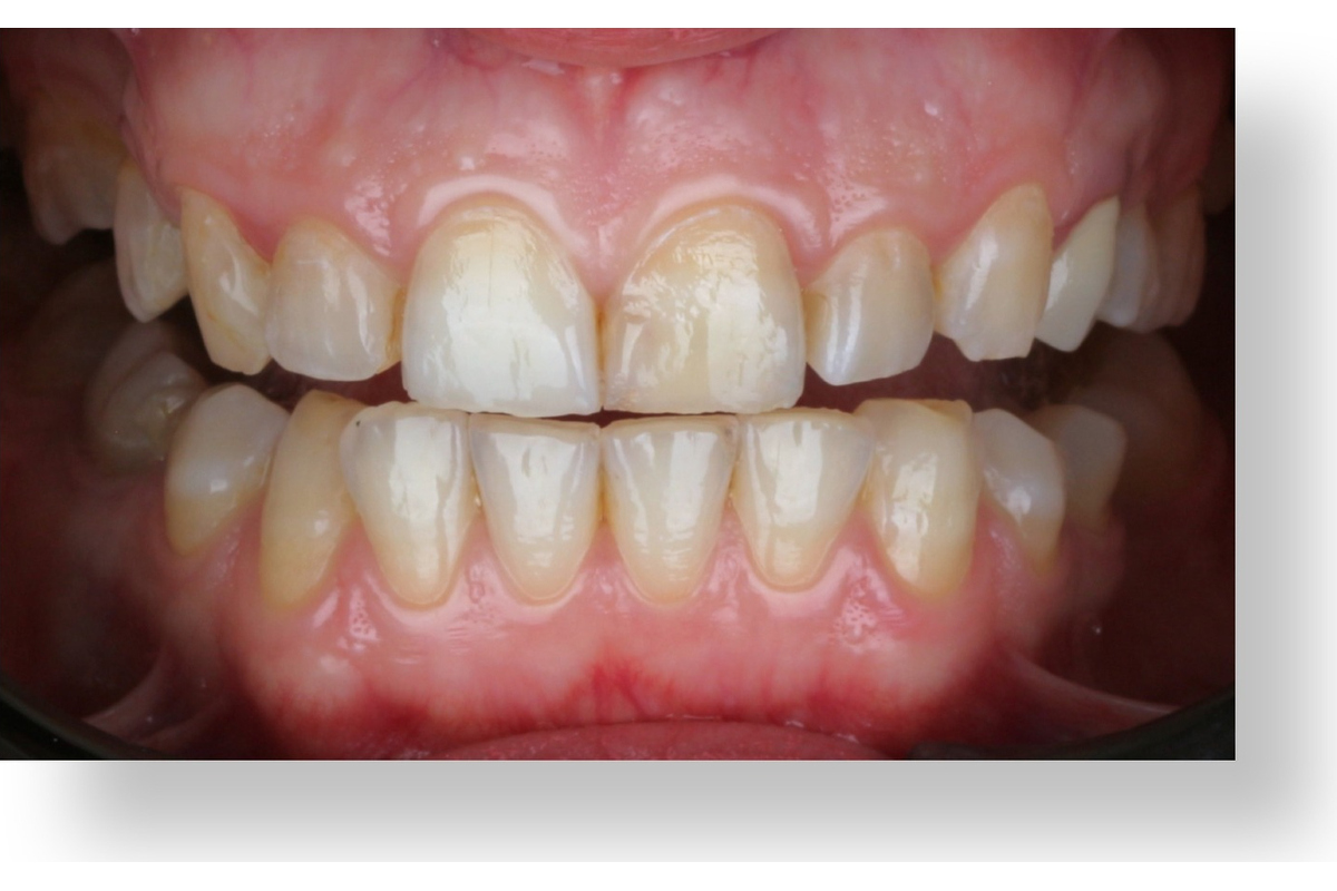 Before image