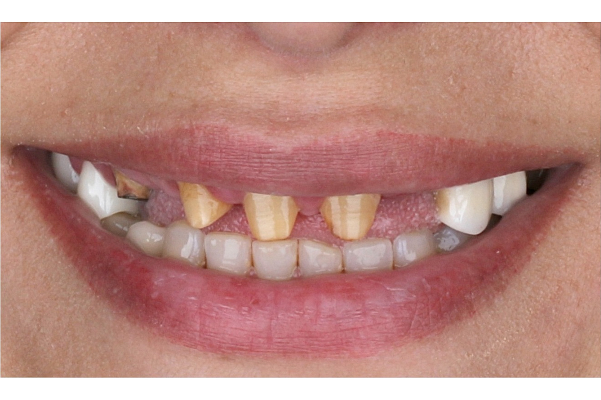 Before image