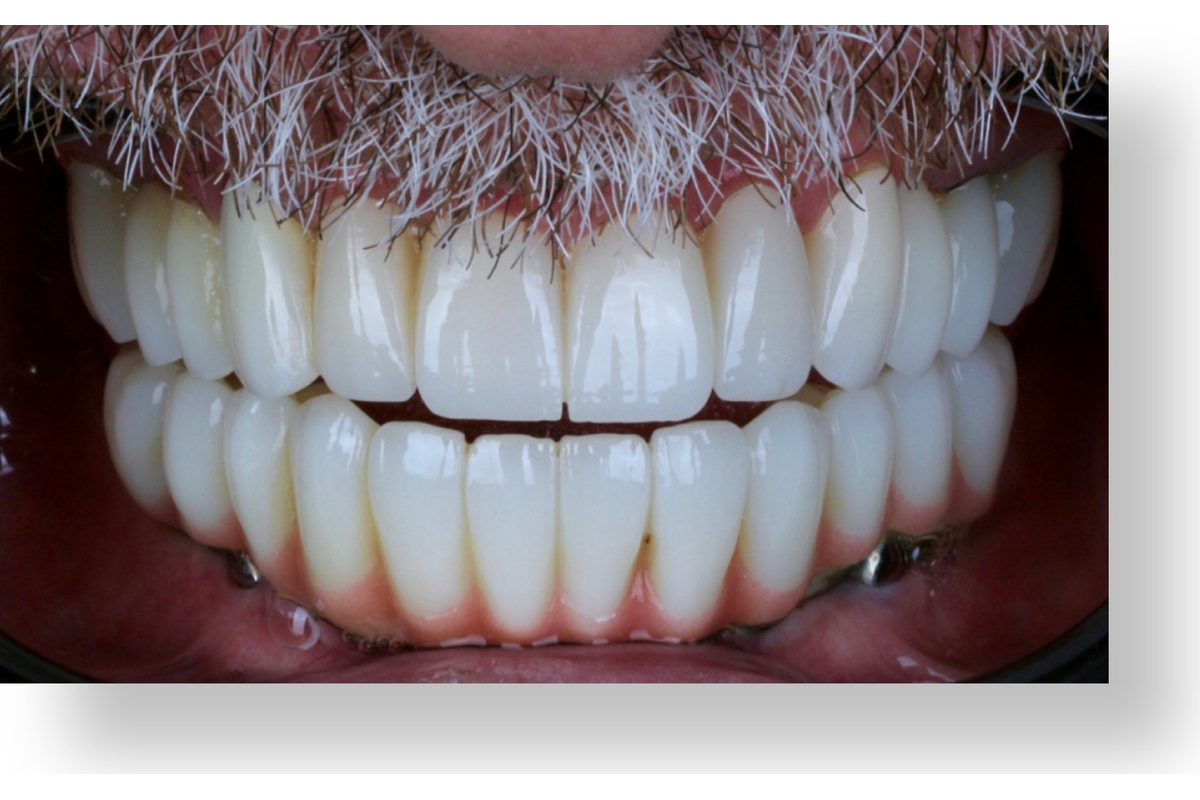 After image