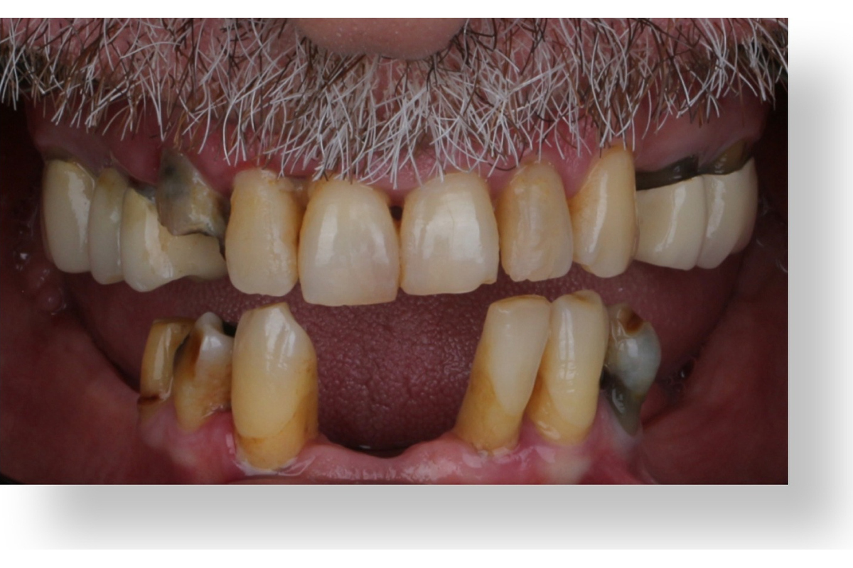 Before image