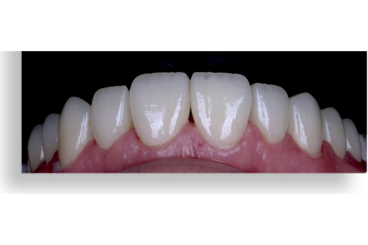 After image