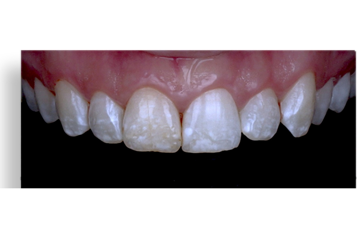 Before image