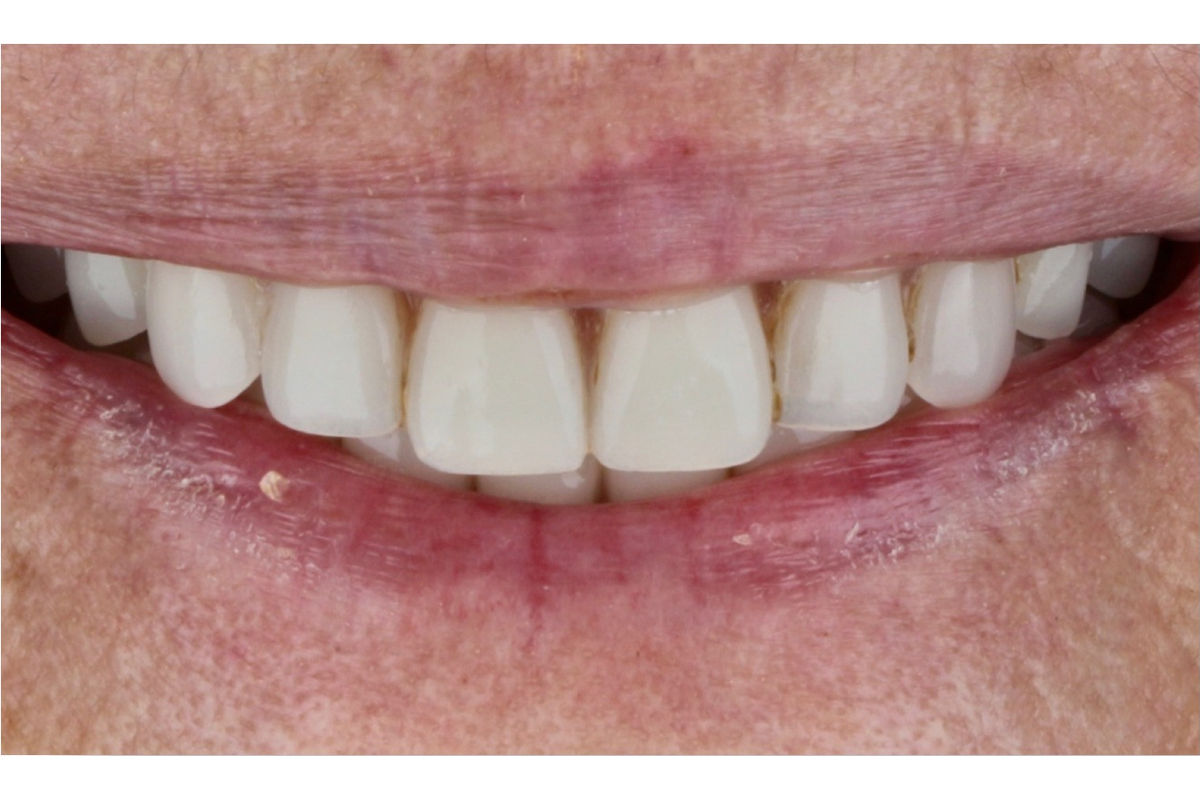 Before image