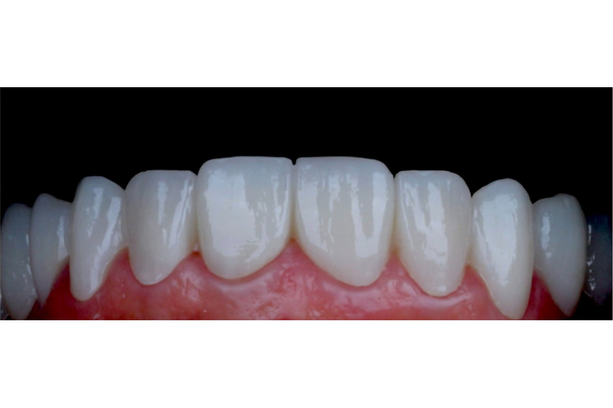 After image