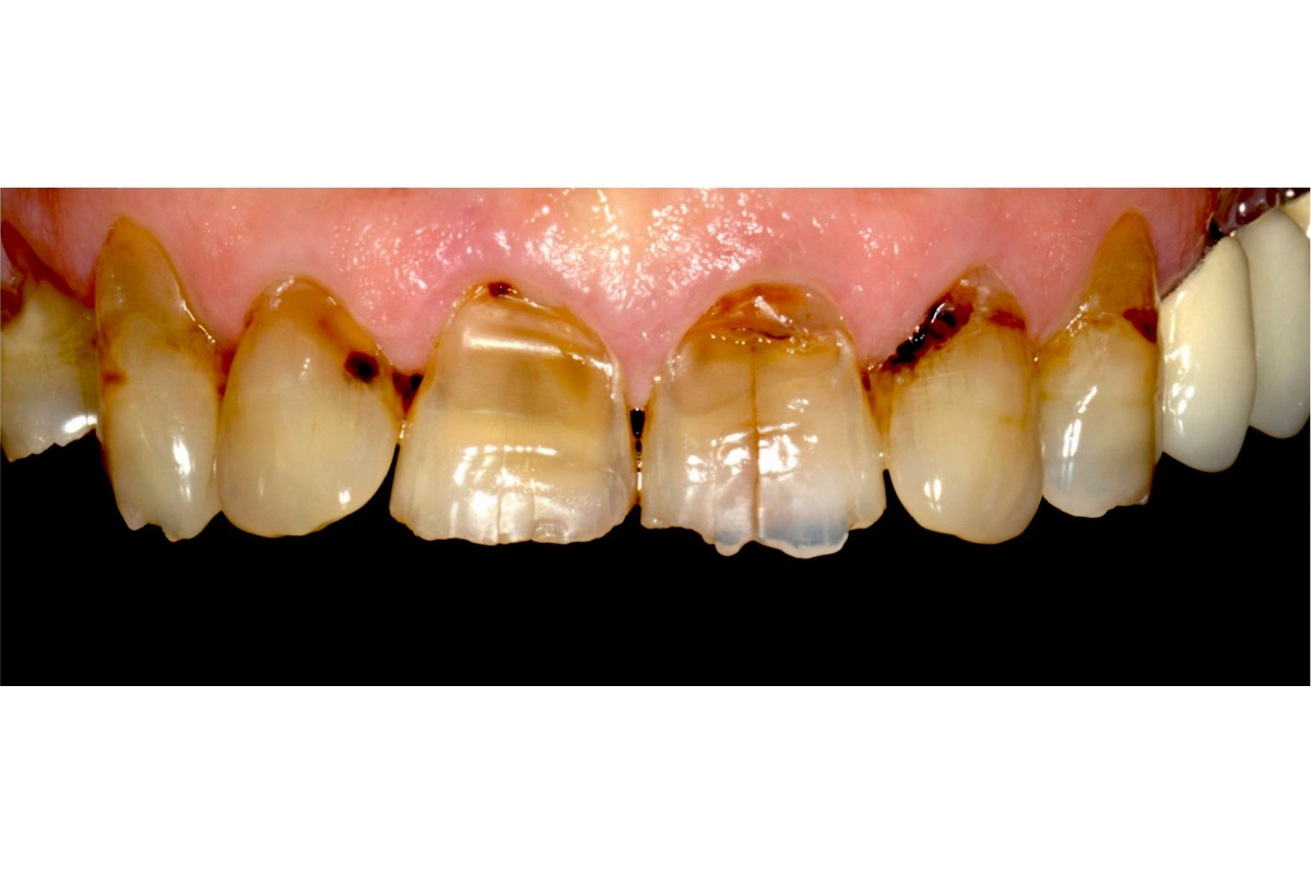 Before image