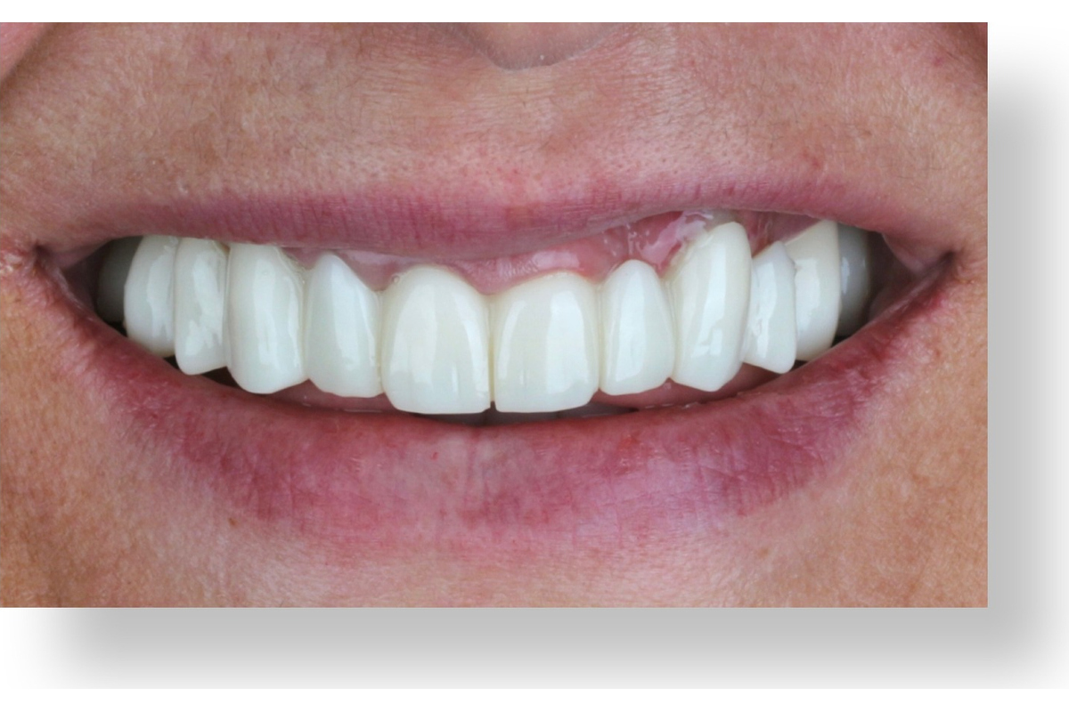 Before image